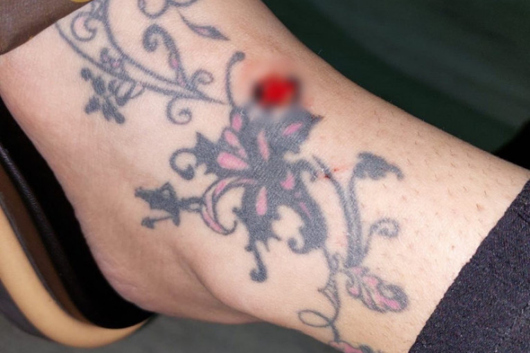 Jelena Radanović povrede