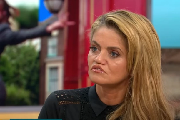 DANIJELA UNAKAZILA LICE DROGOM, ALI "TURSKE GRUDI" SU JOJ ČISTA DESETKA! Doktor je ošamario, kosti joj propale ipak ona ne odustaje! (FOTO)