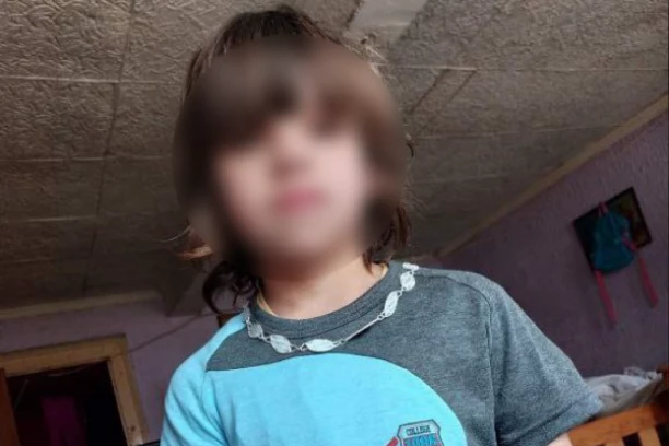 PALILA VATRU, PA ZADOBILA OPEKOTINE PO LICU I TELU: Oglasio se otac teško povređene devojčice (7) - izneo detalje incidenta u Melencima!