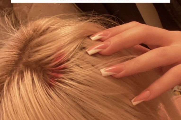 Ruža Rupić sebi "otvorila glavu"