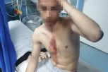 UŽAS U SMEDEREVU: Dečaka prebili iz čista mira, očajni otac objavio fotografije (FOTO)