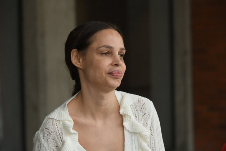 Ovako izgleda Nataša Šavija nakon prebijanja