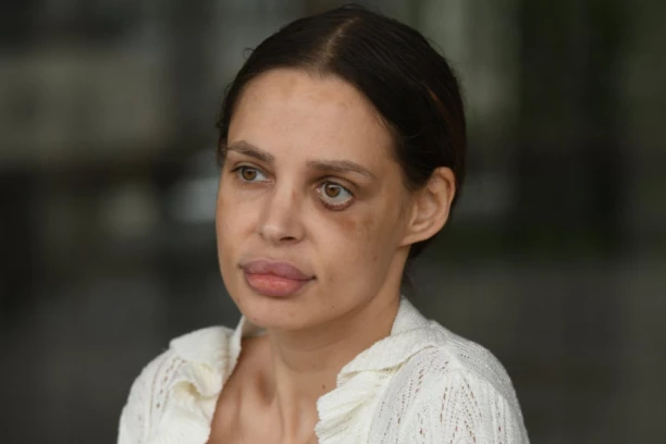 PRETUČENA ŠAVIJA ZAPENILA ZBOG ONOGA ŠTO JE SLOBINA ŽENA DOŽIVELA PRED DETETOM: Javno se obratila Jeleni, pa postavila jedno pitanje!