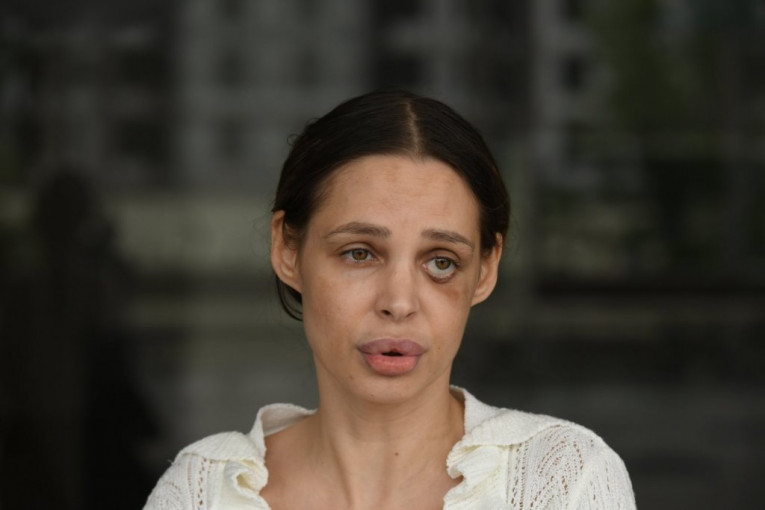 Nataša Šavija nakon prebijanja