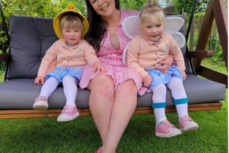 Na ultrazvuku nisu mogli da shvate zašto je jedna beba toliko veća. 