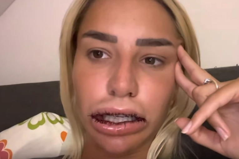 Aleksandra Nikolić usta