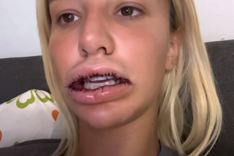 Aleksandra Nikolić izvadila biopolimer