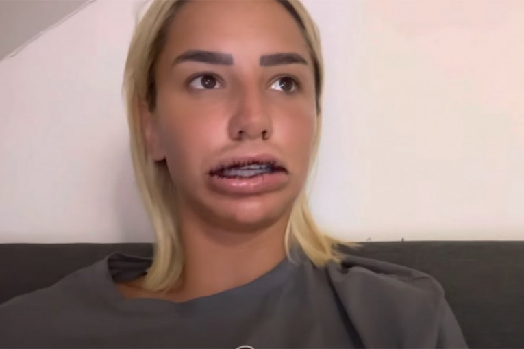 Aleksandra Nikolić opercija usta