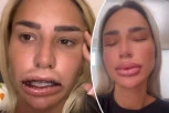 ALEKS PONOVO OTIŠLA POD NOŽ: Zbog Dejana izvadila usta, a sada ih opet stavila, fanovi UŽASNUTI njenim licem! (FOTO)