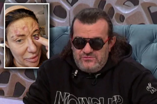 ACA LUKAS OTKRIO ISTINU O ANI NIKOLIĆ I NJENOM STANJU: Sve sam uradio da joj pomognem, ali ona sebi želi NAJGORE!