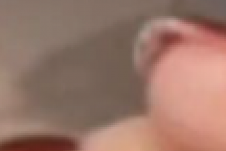 Ana Nikolić, rane po prstima