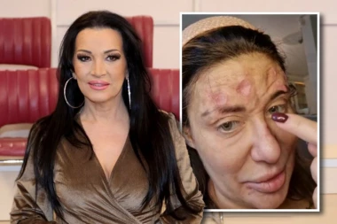 ''SVI SU DIGLI RUKE OD NJE!'' Goca Božinovska progovorila o alarmantnom stanju Ane Nikolić: ''Ni majka joj nije tu!''