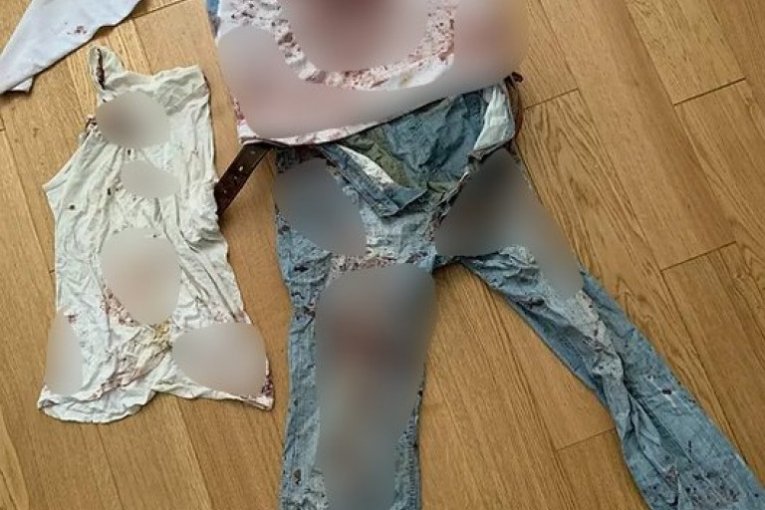 Krvava odeća žrtve