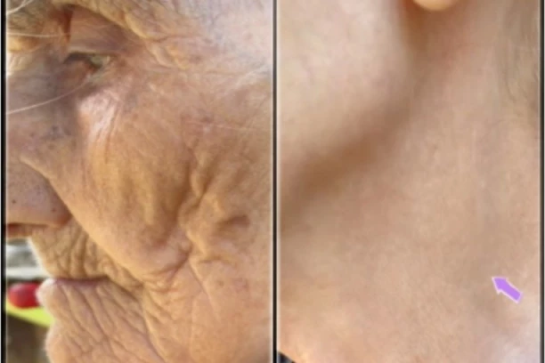BAKA (96) SKINULA JE MARAMU NAKON 80 GODINA: Kada budete videli KOŽU koja je bila sakrivena, bežaćete od SUNCA! (VIDEO)
