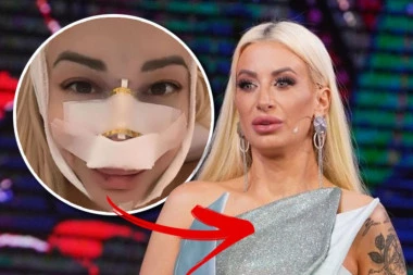 DUŠICA U ZAVOJIMA PREKO CELOG LICA! Voditeljka Pinka se oglasila iz bolničkog kreveta nakon operacije! (FOTO)