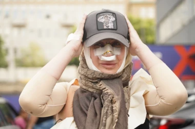 PREMIJERA NOVOG NOSA! Dušica Jakovljević skinula zavoje, pa počastila fanove prvom fotografijom posle operacije!