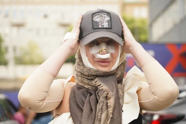 PREMIJERA NOVOG NOSA! Dušica Jakovljević skinula zavoje, pa počastila fanove prvom fotografijom posle operacije!