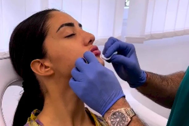 ŠOK FOTKE IZ PROŠLOSTI ANĐELE ĐURIČIĆ: Starleta promenila LIČNI OPIS estetskim korekcijama, evo kako je izgledala ranije!