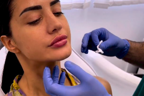 Anđela Đuričić usne