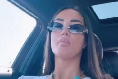 USNE NARASLE KAO KROFNICE: Evo kako Anđela izgleda nakon korekcije, vide se UBODI od igle! (FOTO)