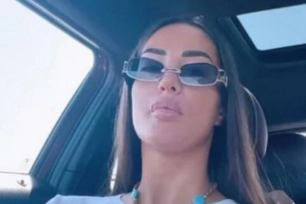 USNE NARASLE KAO KROFNICE: Evo kako Anđela izgleda nakon korekcije, vide se UBODI od igle! (FOTO)