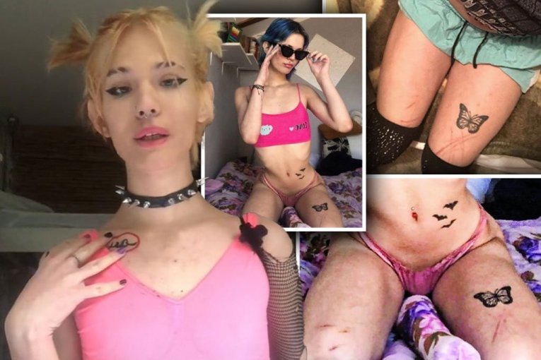 Noa Milivojev samopovređivanje