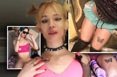 NOU UBICA NAGOVARAO DA SEČE VENE: Posekotine na rukama i nogama otkrivaju MRAČNU TAJNU! (VIDEO)