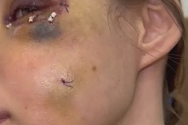 POŽELELA SAMOJ SEBI SMRT! Šavija se oglasila nakon prebijanja, evo šta joj je sve prolazilo kroz glavu! (FOTO)