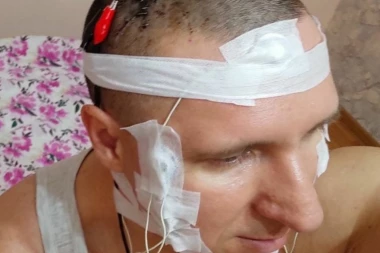 BUŠILICOM OTVORIO LOBANJU: Mihail sam sebi OPERISAO MOZAK, želeo je da ugradi elektrodu i kontroliše snove, ali za dlaku je izbegao SMRT!