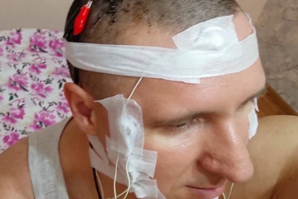 BUŠILICOM OTVORIO LOBANJU: Mihail sam sebi OPERISAO MOZAK, želeo je da ugradi elektrodu i kontroliše snove, ali za dlaku je izbegao SMRT!