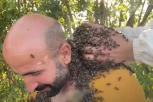 POKRIVA TELO ROJEM PČELA I SVE RADI ZBOG OVOGA: Razlog je fascinantan, a svi se pitaju DA LI JE OVO NORMALNO?! (FOTO)