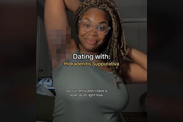 KADA PODIGNE RUKU LJUDI SAMO ŠTO NE POVRATE: Čvorove prazni svakih pet dana, a plaši se da će je zbog pazuha muškarci odbijati (FOTO/VIDEO)