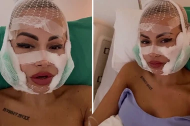BIVŠA ZADRUGARKA TRPI STRAVIČNE BOLOVE NAKON OPERACIJE: Stavlja hladne obloge na lice, otok nikako da spadne! (FOTO)