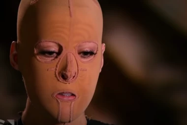 SRPKINJU JE LJUBOMORNA ŽENA ŽIVU ZAPALILA: Dana je imala 200 operacija, dve i po godine nosila je MASKU, a onda je pokazala VELIKU transformaciju - NE MOGU JOJ NIŠTA (FOTO)