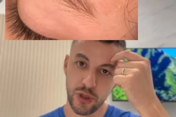 POGLEDAJTE KAKO JE SRPSKI HIRURG DUBOKU RASEKOTINU ĆERKI ZALEPIO SUPERLEPKOM! Suncobran joj razbio glavu u Grčkoj, morao brzo da reaguje! (VIDEO)