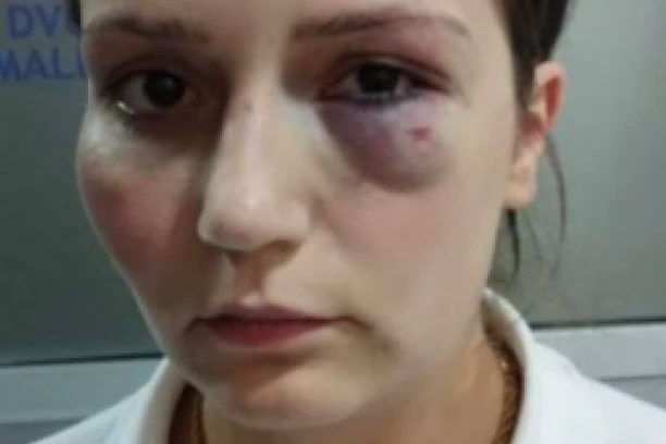 PROTESTI U JABLANICI ZBOG KRVNIČKI PRETUČENE RADNICE HOTELA! Narod na ulicama zbog stravičnog nasilja!