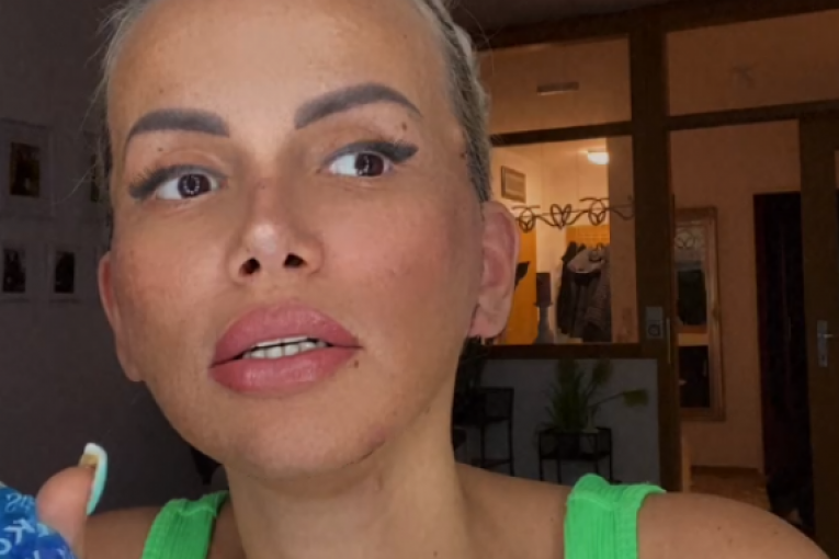 Ermina Pašović nakon operacije lica