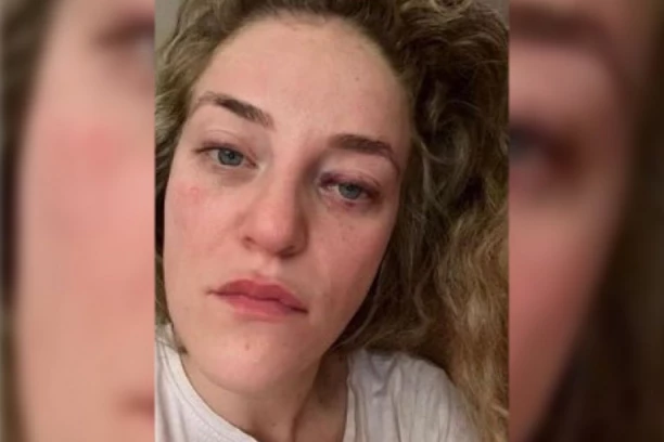 MAJKA "SREDILA" DA SIN NASILNIK NE ODGOVARA? Nada (28) iz Beograda, posle meseci izaludne borbe sa pravnim sistemom, rešila da pravdu potraži preko INSTAGRAMA! (FOTO)