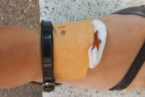 SLAVICU IZ ČAČKA UJEO PACOV PORED MORAVE: Videla sam na nozi dve rupice, a onda sam ugledala i krupnog pacova