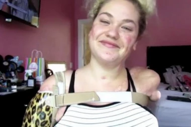 IAKO NEMA RUKE ONA ŠMINKA KAO PROFESIONALAC: Meningitis joj je oduzeo udove, a sada je svojom borbom postala INSPIRACIJA mnogima (VIDEO)