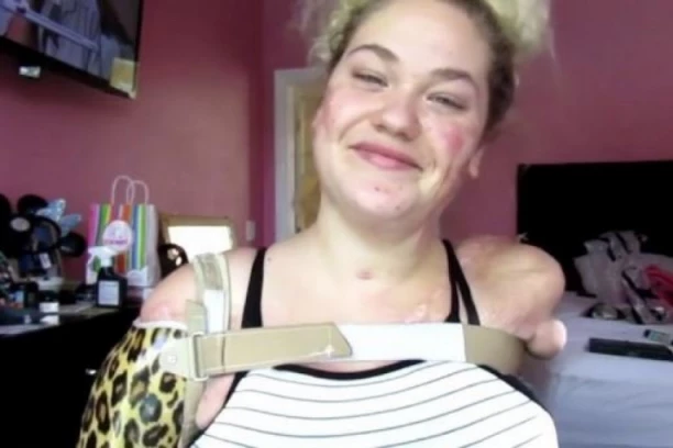 IAKO NEMA RUKE ONA ŠMINKA KAO PROFESIONALAC: Meningitis joj je oduzeo udove, a sada je svojom borbom postala INSPIRACIJA mnogima (VIDEO)