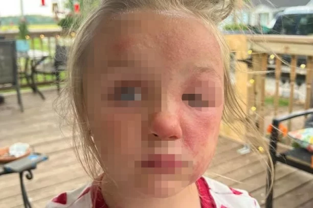 "POMIRISALA JE VRH OVE BILJKE, LICE JOJ JE POSTALO NATEČENO I NIJE MOGLA DA GOVORI": U Srbiji se nalazi TAČNO OVDE, a malo ko zna koliko je OTROVNA