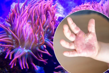 DEČAK (7) JE IZAŠAO IZ MORA I REKAO: "TATA JA ĆU UMRETI"! Panika na plaži, OTAC SE SLEDIO od straha, a onda je stigao TOKSIKOLOG