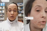 "OVA KREMA STVARA ZAVISNOST, KAD JE KORISTIŠ SIMPTOMI SE POVLAČE, ALI SE VRAĆAJU U GOREM OBLIKU": Farmaceutkinja Anđela stavljala  je ono što i VEĆINA, pa se desio UŽAS (FOTO/VIDEO)