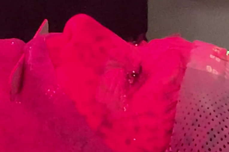 Šenon Doerti metastaze