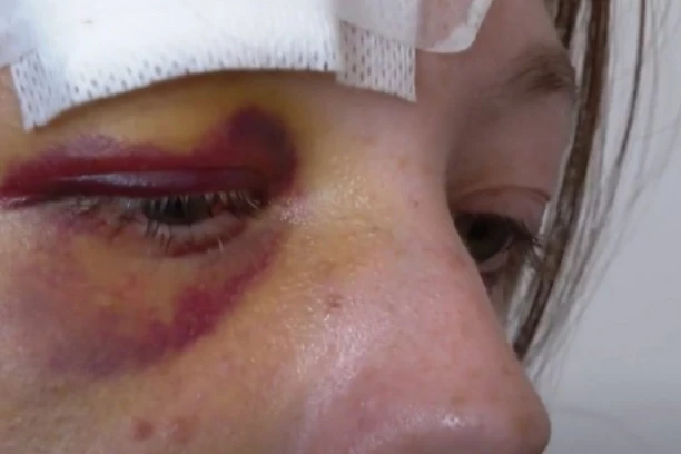 RAZBESNEO SE KAD MU JE ZATRAŽILA DEPOZIT Stanodavac divljački pretukao podstanarku pred decom! Spasao je muž: "Da mene nije bilo, tukao bi je DO SMRTI!"