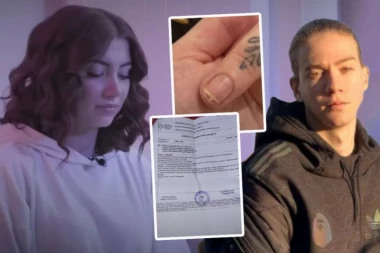 ZLOSTAVLJANA INFLUENSERKA PRILOŽILA DOKAZE O NASILJU: Nika Ilčić objavila jezive fotografije, pa otkrila kako je došlo do INCIDENTA sa tadašnjim dečkom!