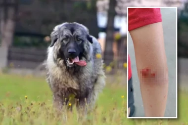 KRVAV I ISKIDANE KOŽE! Evo kako izgleda ruka dečaka kog je krvoločno napao vlasnički šarplaninac! (FOTO)