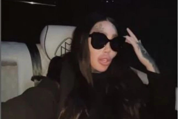 "VRAĆAM SE PRIRODNOM IZGLEDU": Zbog silikona umalo nije UMRLA, ova operacija je najskuplje koštala zdravlja!