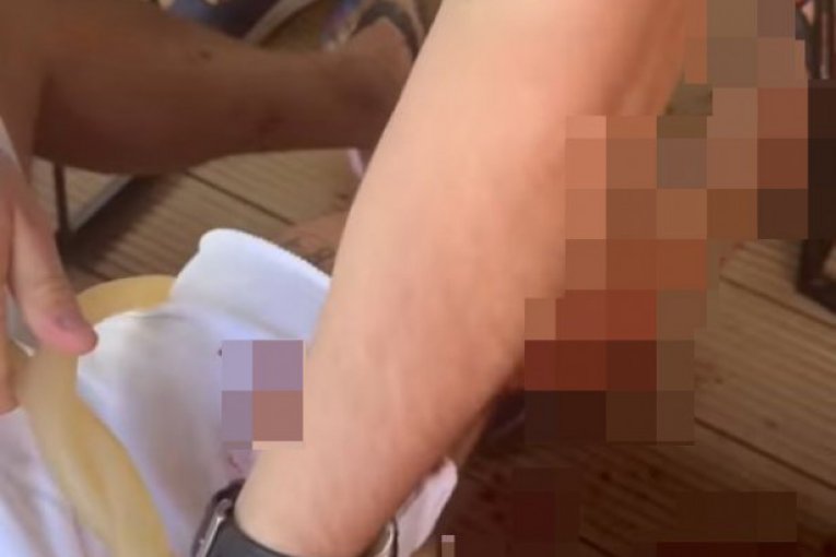 Mirza Hatić ranjen Instagram